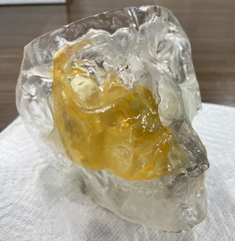3D Printed Skull Using PolyJet Technology 