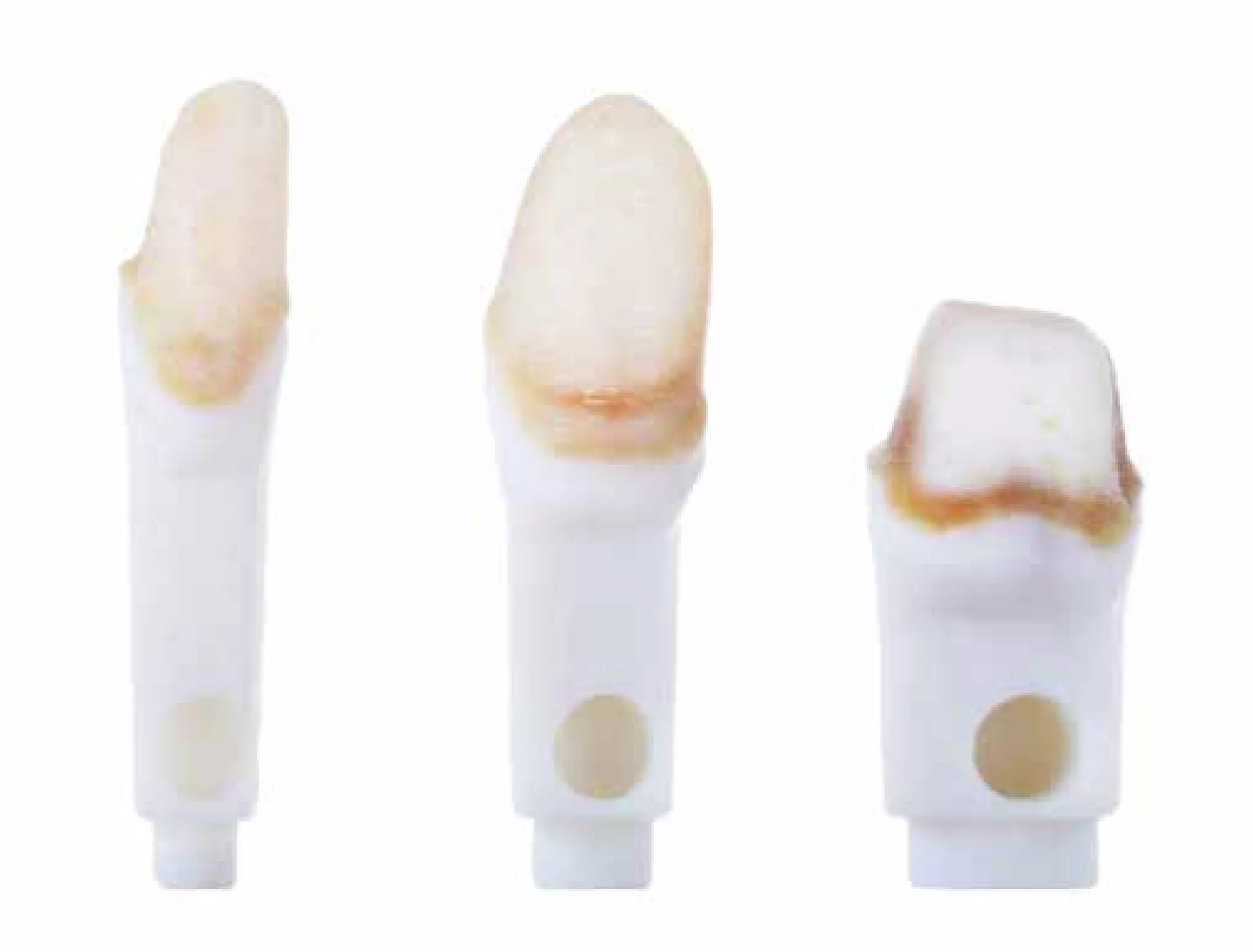 Linz Dental Lab creates prosthetics with 3D printing from Stratasys and GoEngineer.