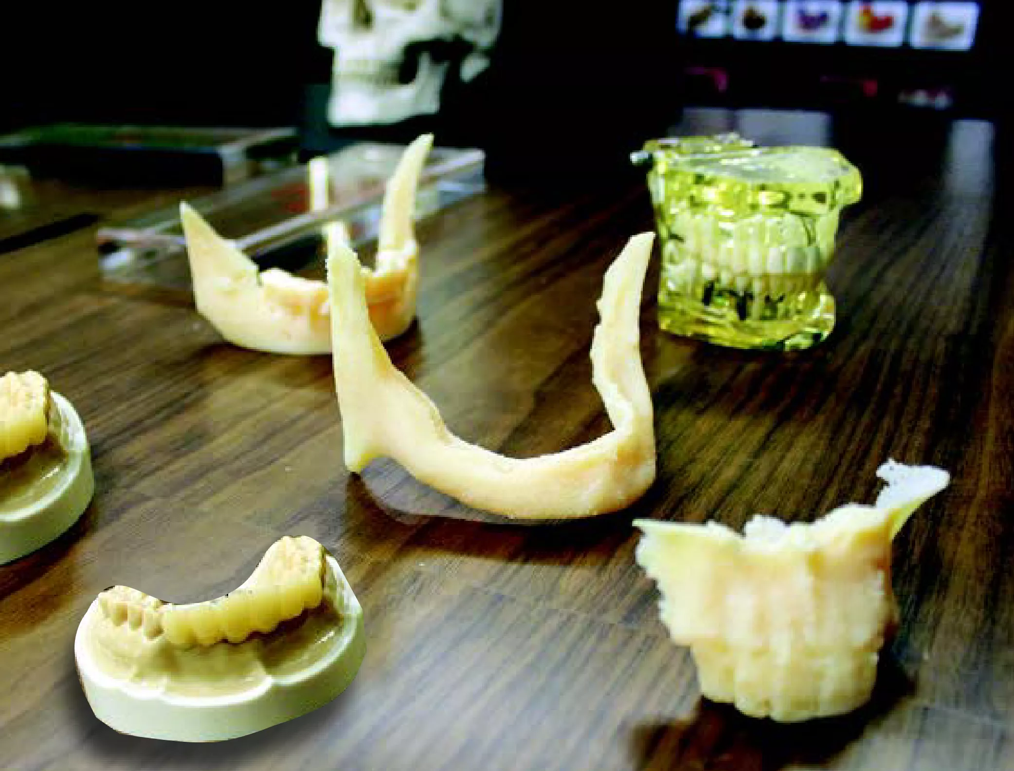 Dental Lab Sense and Beauty creates Maxilofacial models  with 3D printing from Stratasys and GoEngineer.
