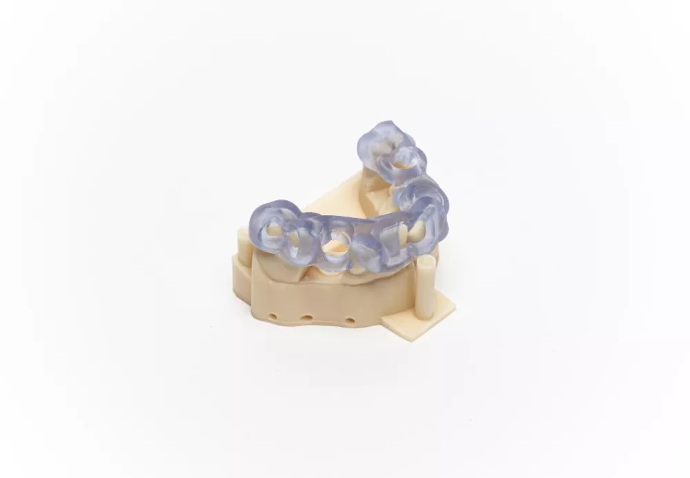KeyGuide Implant Model Printed on Stratasys Origin One Dental 3D Printer