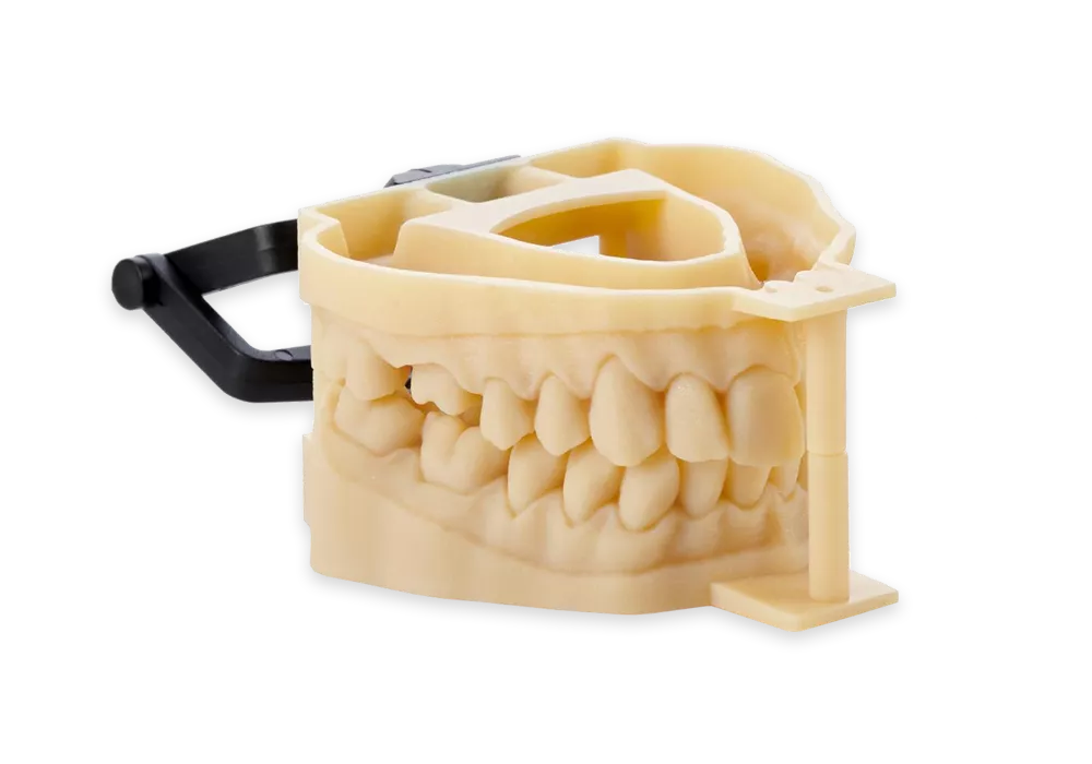 Crown and Bridge 3D printed on the Stratasys J3 DentaJet 3D Printer. 