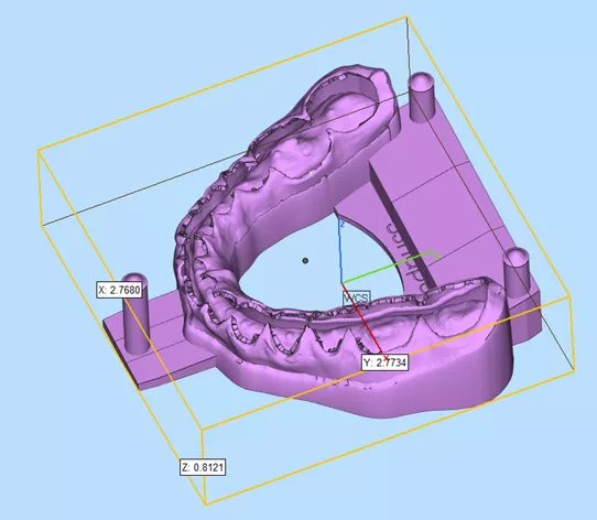 Dental Model in Materialise Magics 3D Printing Software