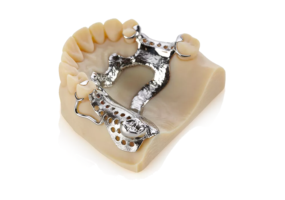 Dental removable model 3D printed on the Stratasys J3 DentaJet 3D Printer. 