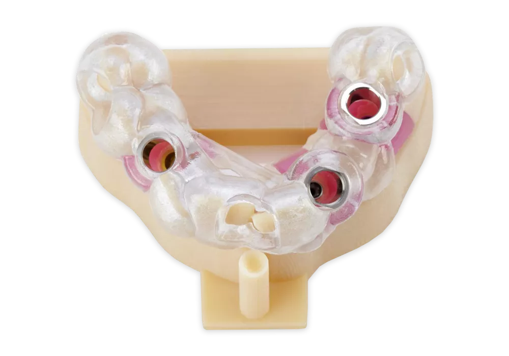 Dental Implantology base model 3D printed on the Stratasys J3 DentaJet 3D Printer. 