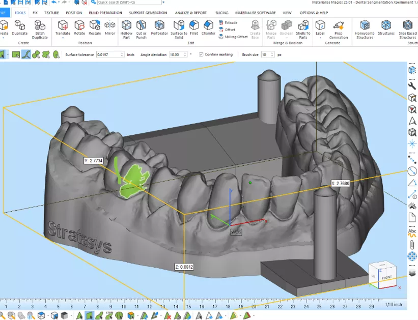 dental model in materilise magics 3d printing software