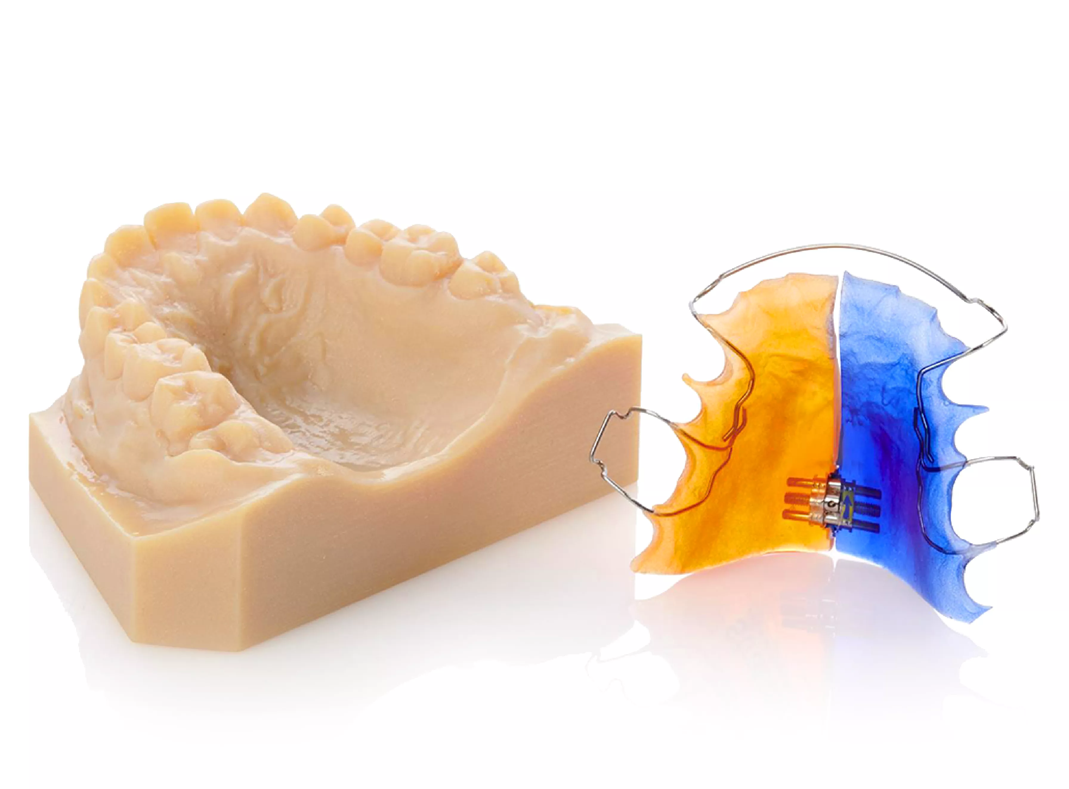 Dental Orthodontics prototypes 3D printed on Stratasys Polyjet 3D printers with multi materials