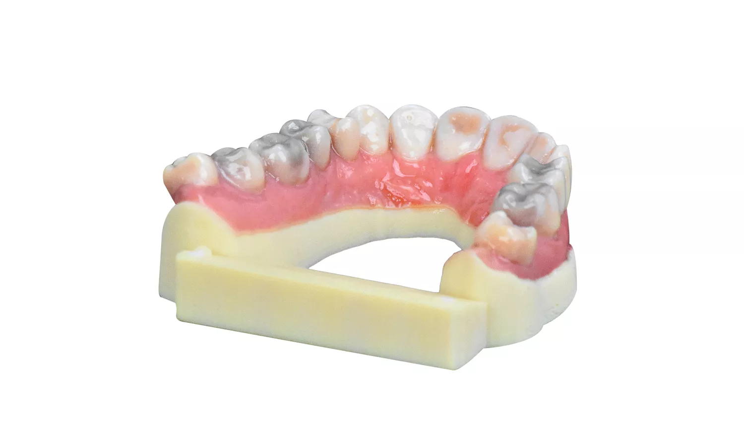 Stratasys J720 full color dental models.