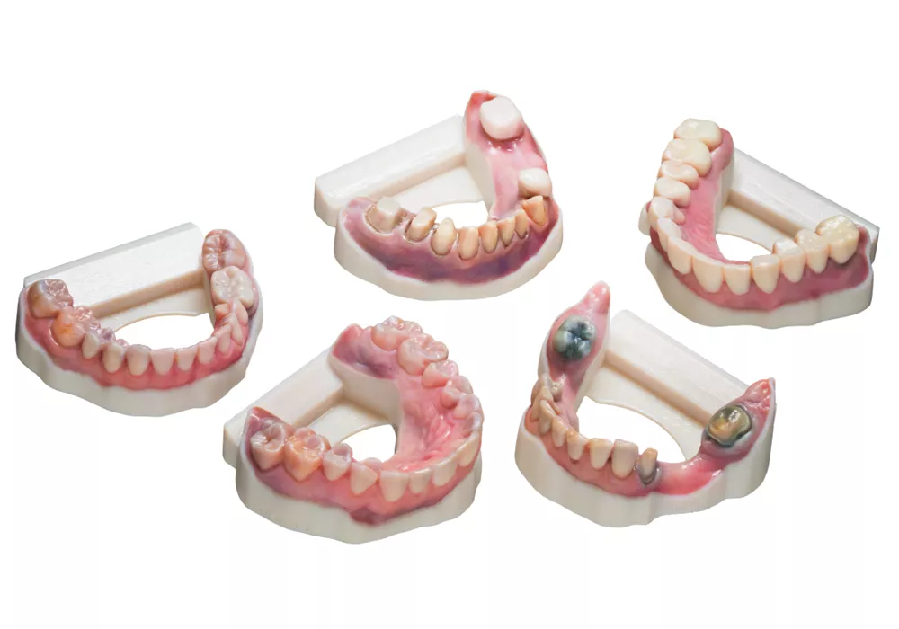 Stratasys Vero Vivid Colors translucent dental 3D Printer resin. 