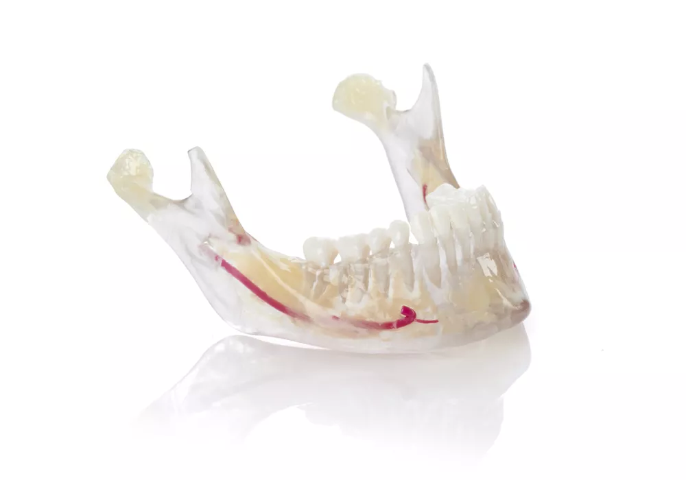 Stratasys VeroDent PureWhite DEN847 dental 3D Printer resin. 